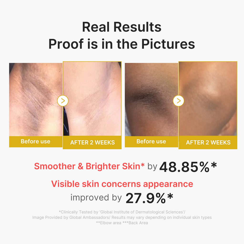 Kojic Acid Turmeric Body Peel Shot N9