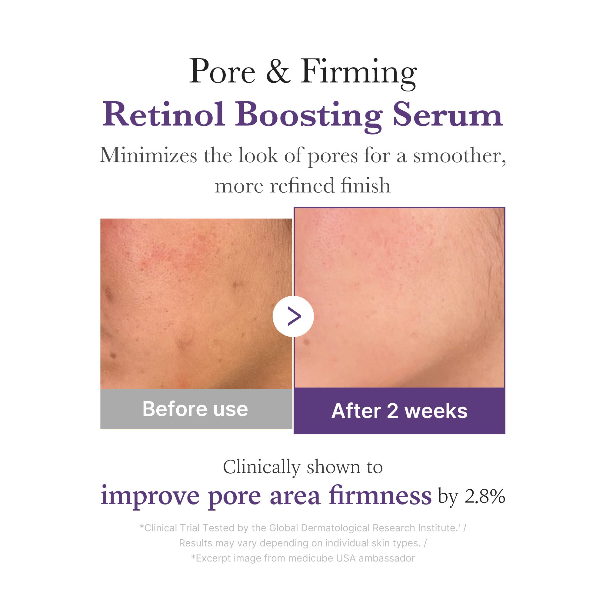 Retinol NMN Boosting Serum C7