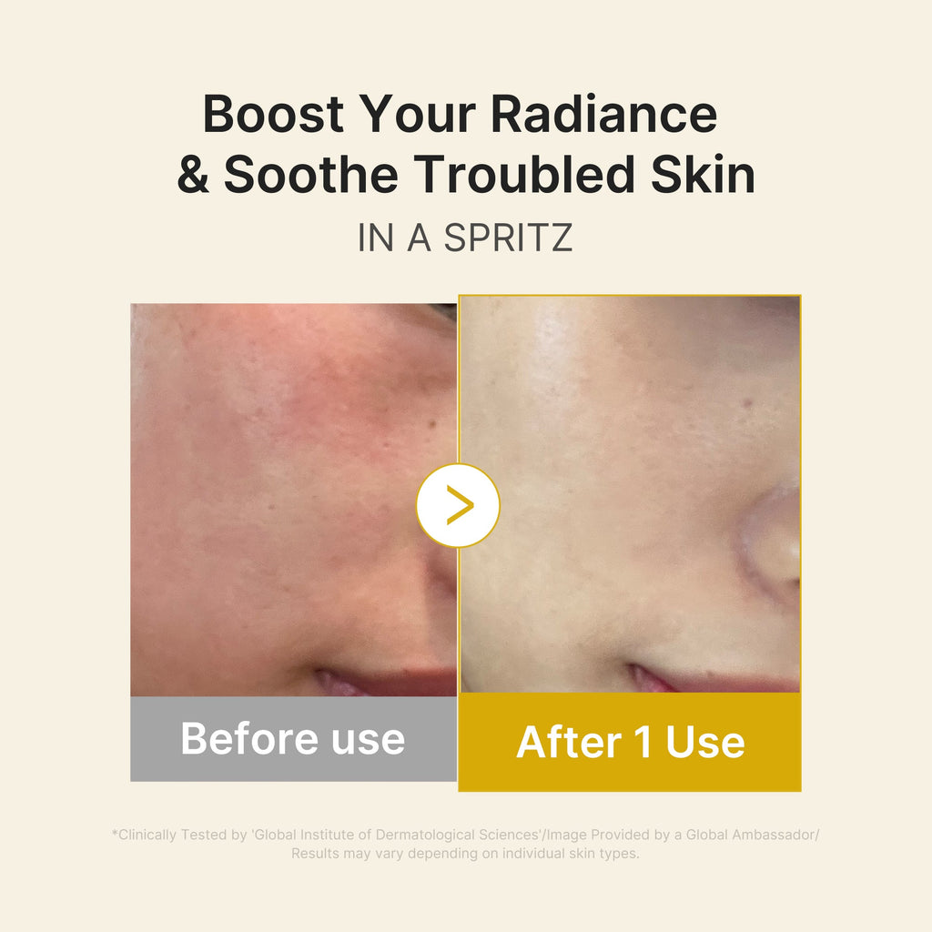 Kojic Acid Turmeric Vitamin Gold Jelly Mist Serum E5