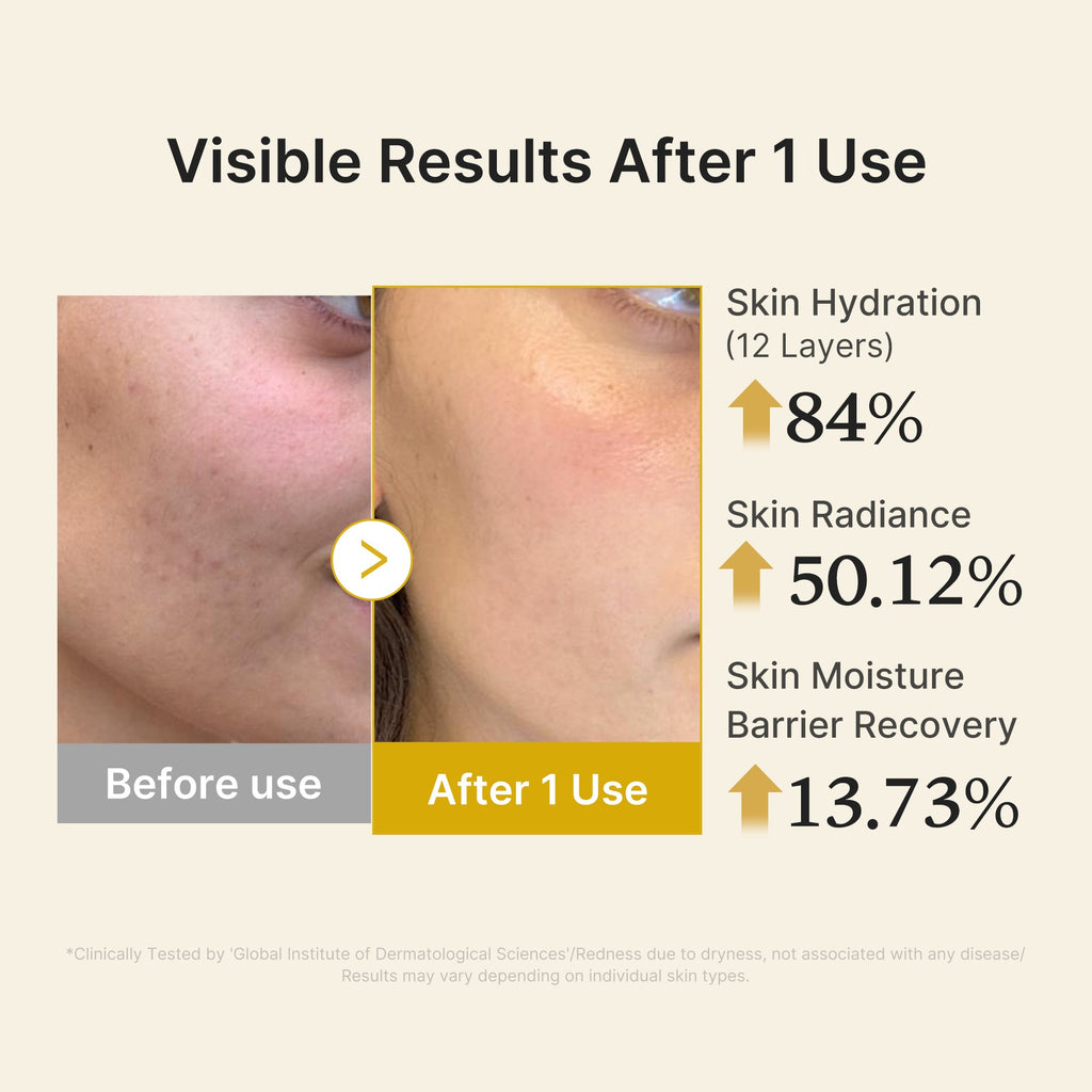 Kojic Acid Turmeric Vitamin Gold Jelly Mist Serum E5