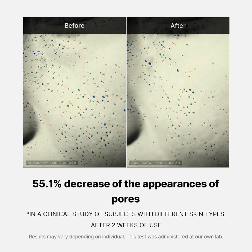 Pore Care Duo S0