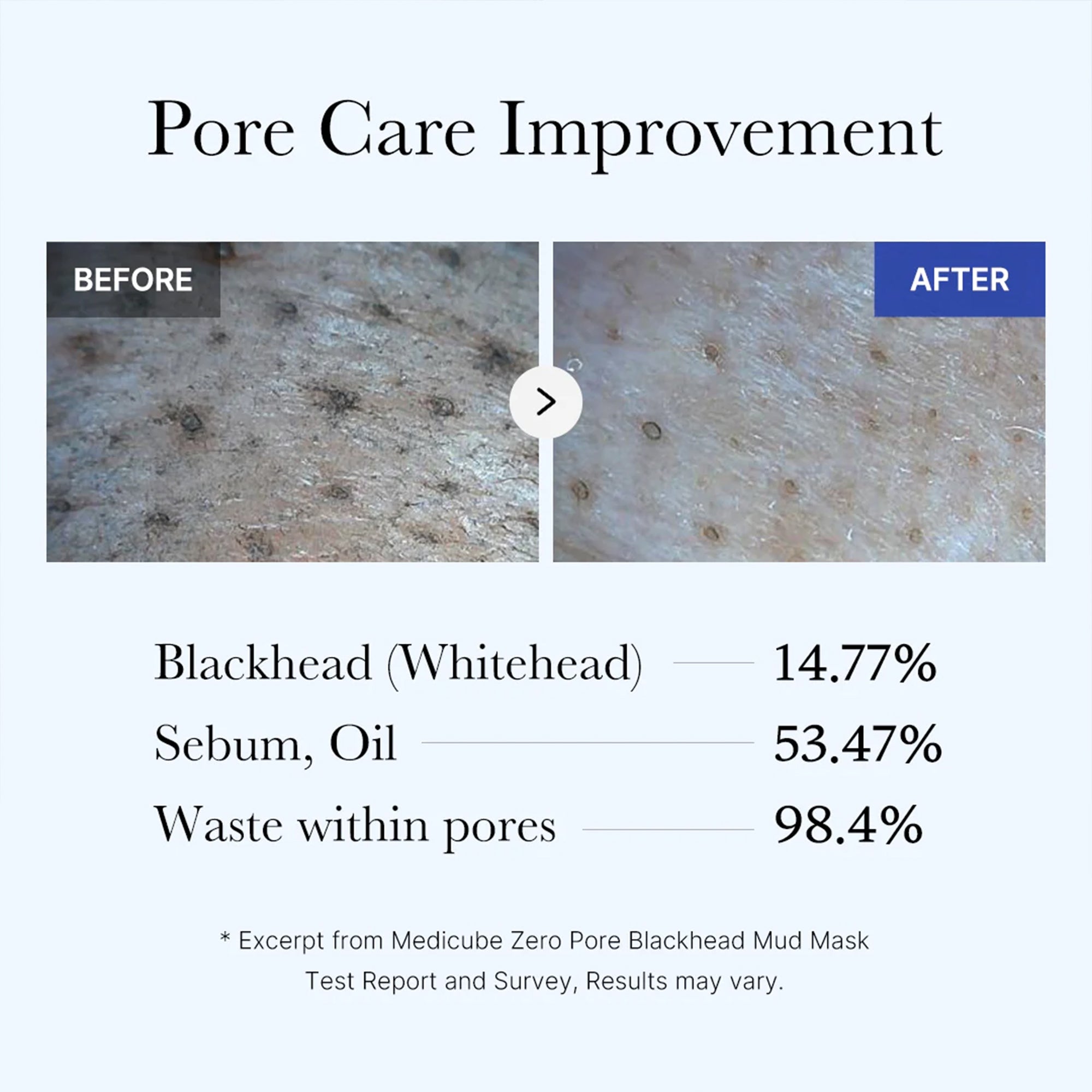 Zero Pore Blackhead Mud Mask O6