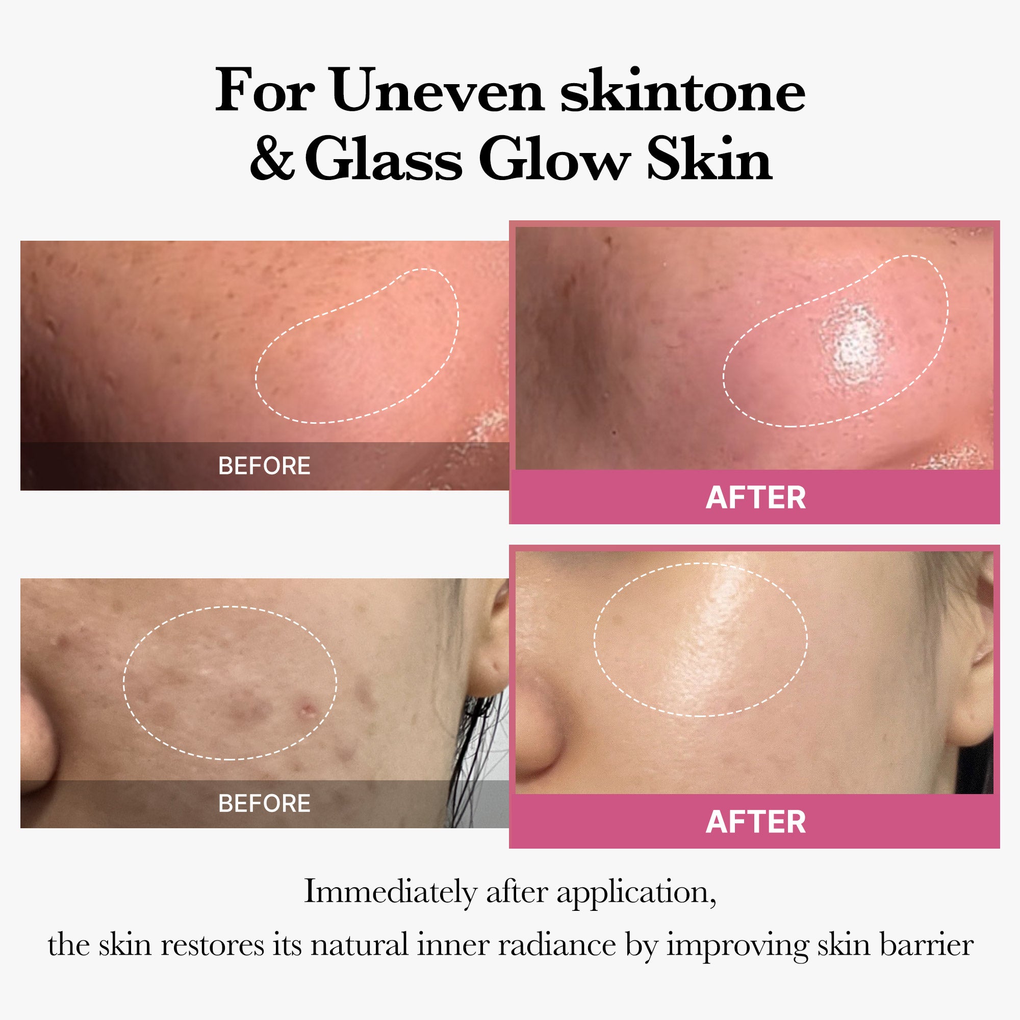 [Tati's Exclusive] Plump Perfection Set J2